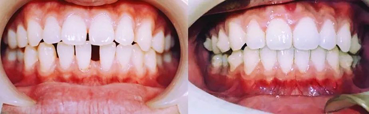 1512024304182611.jpg 1512024304182611.jpg